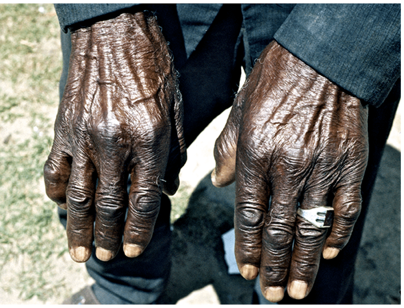 1974 - Bartow, FL  Charles Smith's hands
