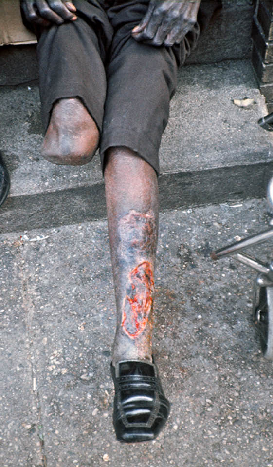 1974 - Jacksonville, FL 