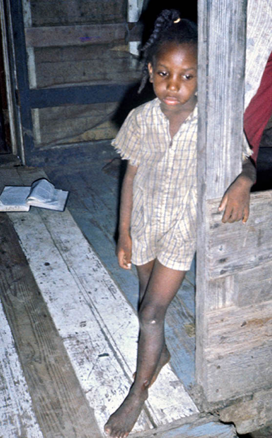 1975 - rural Meridian, MS