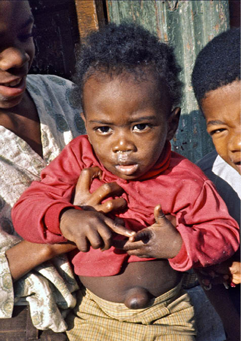 1973 - Baltimore