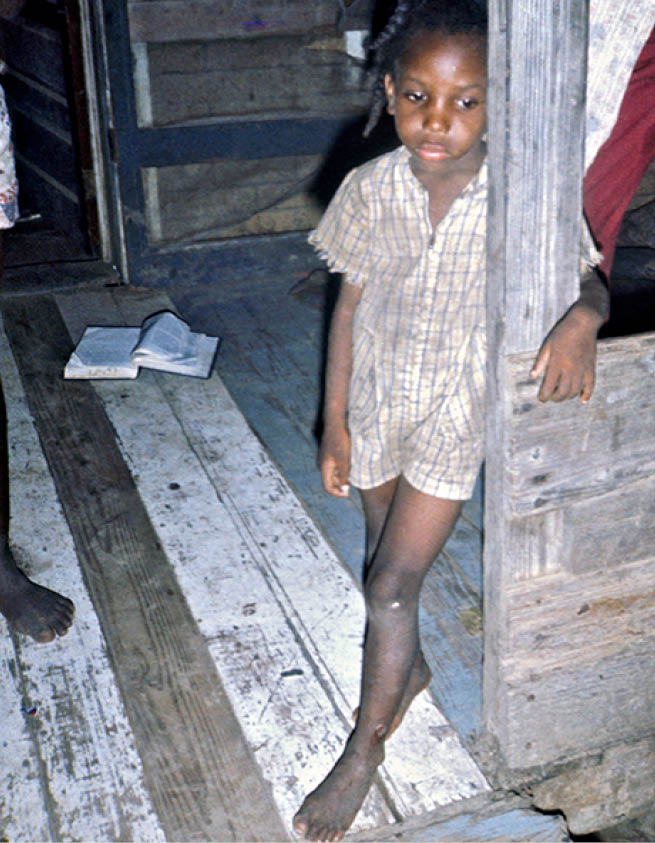 1975 - rural Meridian, MS