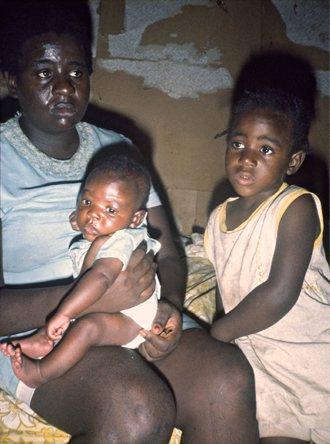 1975 - Philadelphia, MS